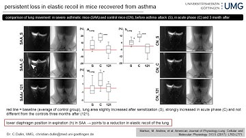Better Data, Fewer Mice: micro-CT Imaging Breathes New Life into your Lung Research