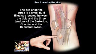 Pes Anserine Bursitis - Everything You Need To Know - Dr. Nabil Ebraheim