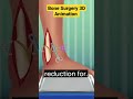 credit#bones#surgeryeducation#3danimation#@drdushyantortho #educationalvideo #studymotivation