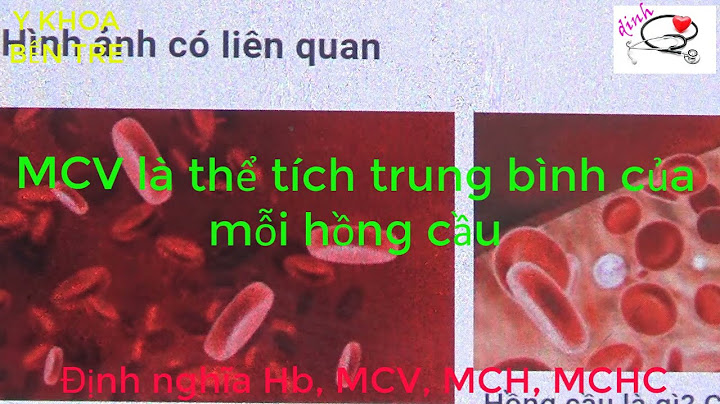 Chỉ số mcv trong máu là gì