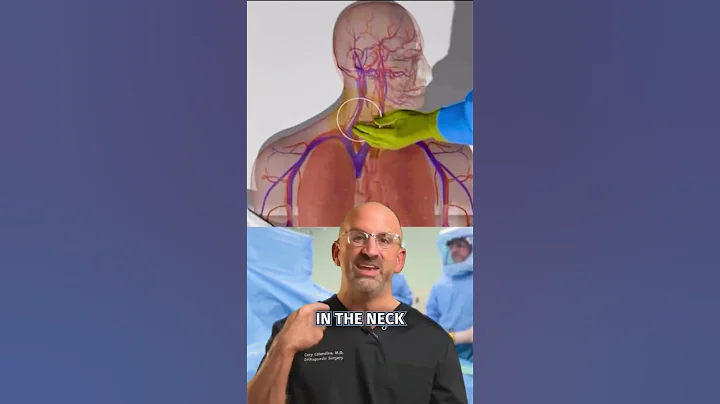 Top 3 Central Line Advantages #shorts