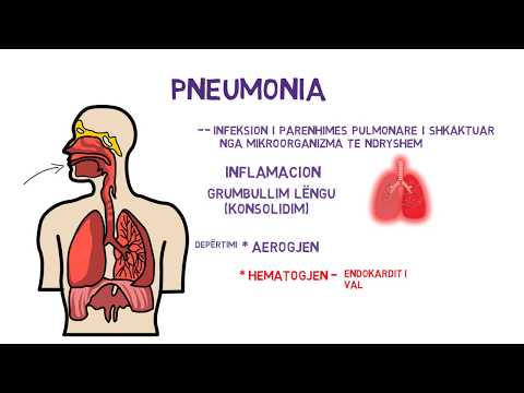 Pneumonia - Shkaqet, patogjeneza, klasifikimi, klinika, diagnoza - E THJESHTËSUAR!