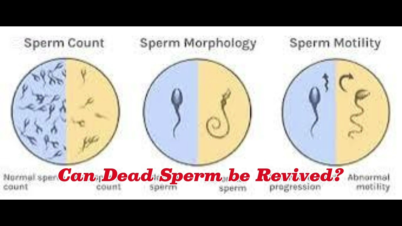 When you hear sperm viability, what does it mean?
