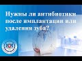 Нужны ли антибиотики после имплантации или удаления зуба?