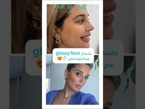 جلسة   مع الجميلة أسيل الرويشد د أماني ناجي طبيبة التجميل الكويت فيلر بوتكس تجميل