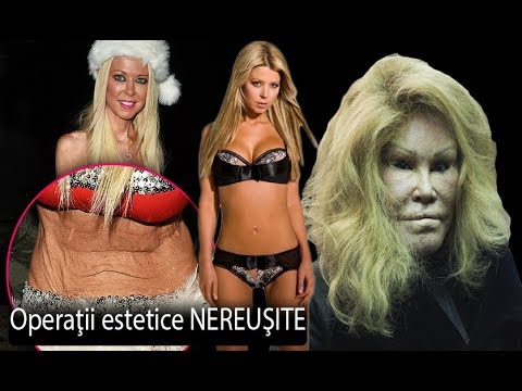 Video: Top 6 Operații Plastice în