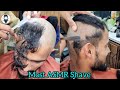 HeadShave|👌Most ASMR barber Dandruff head shave for young Men's change look 2025✔️