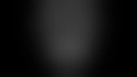 Pharyngeal Flap for Velopharyngeal Insufficiency