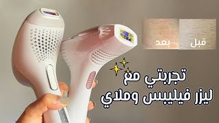 تجربتي مع ليزر ملاي وفيليبس | ومقارنة بينهم بالتفاصيل المهمة وبالصور😍✨