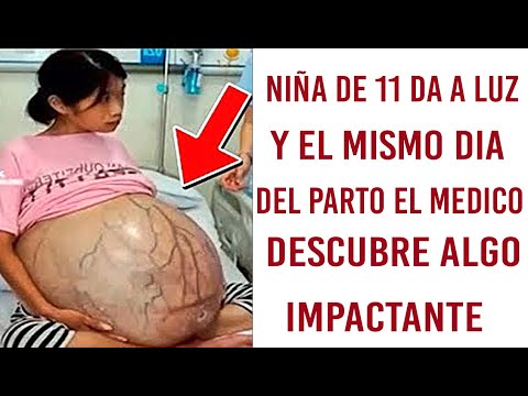niña-de-11-años-da-a-luz-y-el-mismo-día-del-parto-el-doctor-descubre-algo-impactante