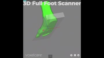 3D Full Foot Scanner
