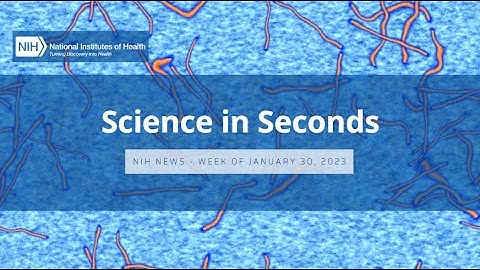 NIH Science in Seconds – Week of January 30, 2023