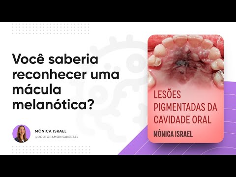 Vídeo: O que é mácula melanótica oral?