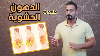 اهم العلامات التي تدل على وجود الدهون الحشوية، اكتشفها الآن