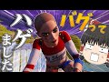 【Fortnite】バグでスキンがハゲてるんだけどwwww永遠の初心者が行くフォートナイトパート82【ゆっくり実況】
