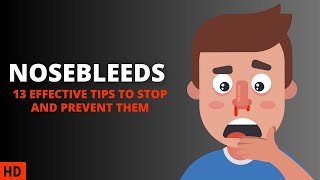 Nosebleed 101: What You Need to Know