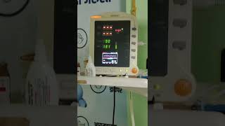 New born baby on C pap ventilator support #newborncare #nicubaby#ventilater #trendingshorts #ytvideo