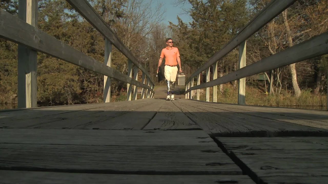 BiLateral amputee Brandon describes his experience with Fourroux Prosthetics
