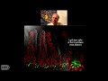 Organoids to Model Human Disease