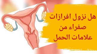 هل نزول إفرازات صفراء من علامات الحمل | ما أسباب ظهور إفرازات صفراء قبل الدورة؟