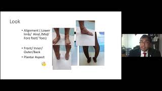 Clinical examination of the foot and ankle for FRCS