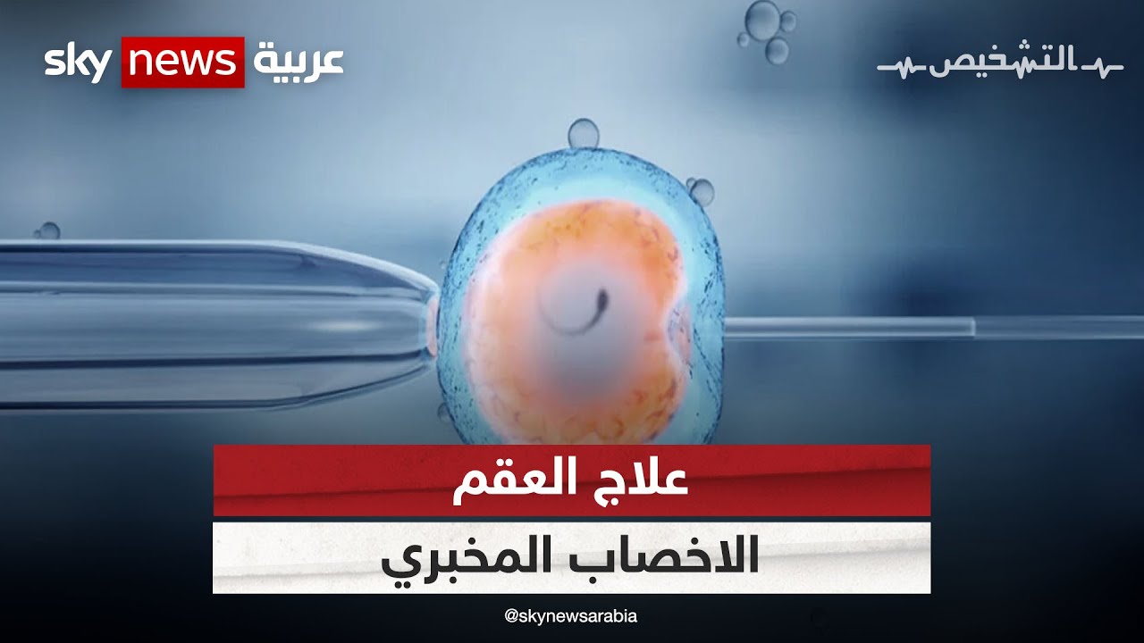 علاج العقم بالإخصاب المخبري| #برنامج_التشخيص