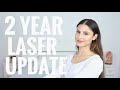 2 YEAR UPDATE | LASER BODY HAIR REMOVAL RESULTS | PCOS | UPDATE 2