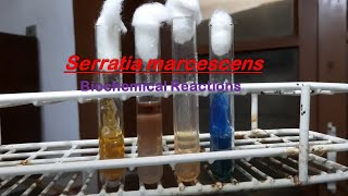 Serratia marcescens Biochemical tests Demonstration