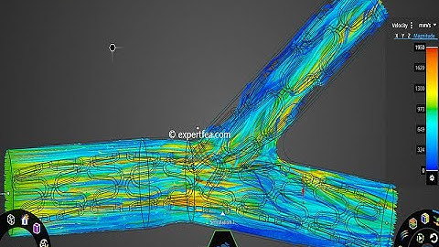 Haemodynamics of Kissing Stents in Aortic Bifurcation Treating  Aortoiliac Disease - ANSYS Discovery