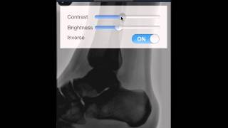 Rapid Reporting Tool Video Demo screenshot 3