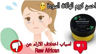 فوايد كريم العين و الهالات السودا Raw African ،و سبب اختلاف الآراء عليه، + نصايح للهالات السودا