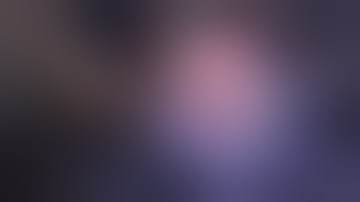 Correction Butt Frame in the Hexapod Circular Fixator - Dr. Ayman Nashashibi - د. أيمن النشاشيبي