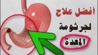 ماهى اعراض جرثومة المعدة??