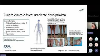 WEBINAR 8  Charcot Marie Tooth CMT