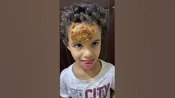 عبودي فيه زعرور 