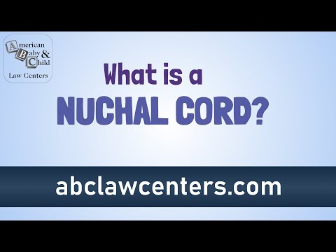 Video: Ce este un cordon nucal?