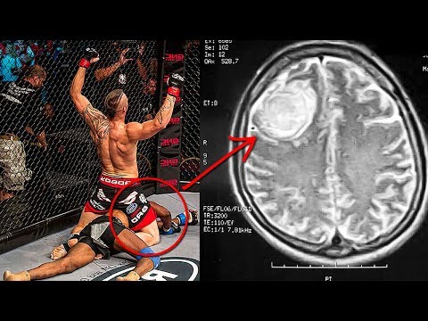 Видео: Кто-нибудь погиб во время боя в UFC?