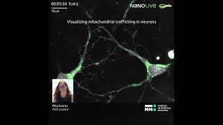 Visualizing mitochondrial trafficking in neurons with Nanolive imaging screenshot 5