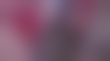 2018 Edited Film Combined Artificial Iris IOL Implantation in Traumatic Aphakia Aniridia