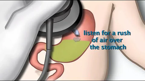 "Nasogastric Tube Placement" by Sue Hamilton for O...
