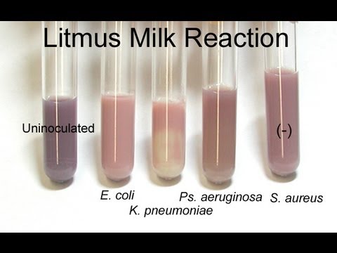 Litmus Milk Test - Amrita University