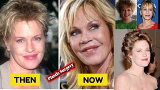 Melanie Griffith Plastic Surgery Facial work she later sought to reverse.