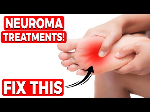 #1 NEW Metatarsalgia, Ball of the Foot Pain, Neuroma Treatments!