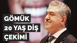 GÖMÜK DİŞ ÇEKİMİ | 20 YAŞ DİŞ | GÖMÜLÜ 20'LİK DİŞ | | M.SC.DT. ZAFER KAZAK