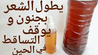 سيذهلكم ما سيحدث كل من رأى شعري تعجب من طوله وكثافته/الفراغات نبت فيها الشعر/علاج تساقط الشعر