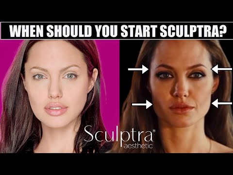 When should You Start  Sculptra? Signs you Should Start NOW