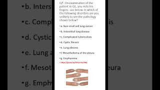 Medicine &amp; Surgery MCQs (For MBBS, USMLE, MCCQE &amp; PLAB)