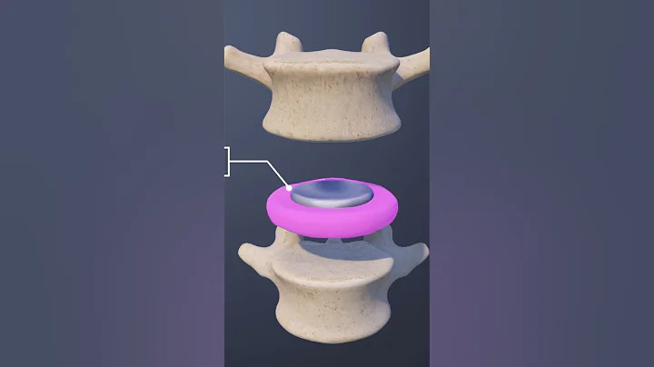 The Intervertebral Disc of the L4-L5 Spinal Motion Segment