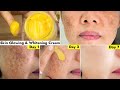 Thisface cream cleared pigmentation in 3 usesremove dark spots  uneven skin get even fair skin