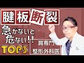 腱板断裂 急いで治療しないと危ないケース TOP3